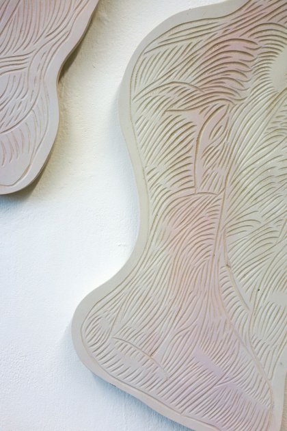 «Muscle aches« by Anastasia Ruchkina, Prof. Klaus Hesse