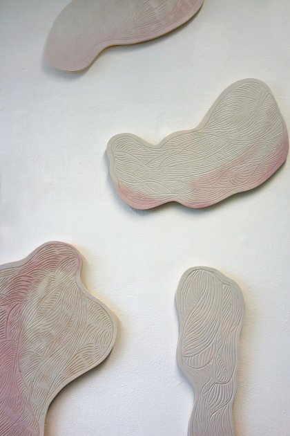 «Muscle aches« by Anastasia Ruchkina, Prof. Klaus Hesse